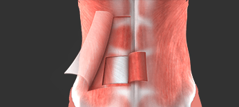 Abdominal Wall Reconstruction