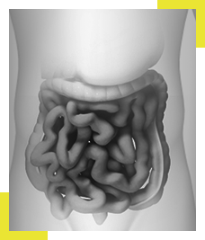 Intestinal Perforation